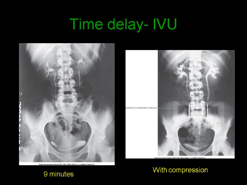 Time delay- IVU 9 minutes With compression